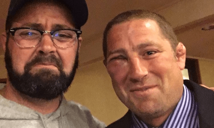 Sumo somehow manages to look worse for wear than a bloke with a busted eye socket. (Photo: Scotty Stevenson)