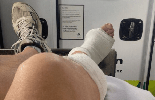 Mark Jennings' leg. Photo: Mark Jennings