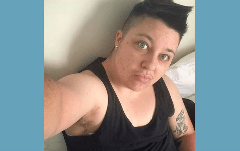 Congratulations, She’s A Boy: I got top surgery!