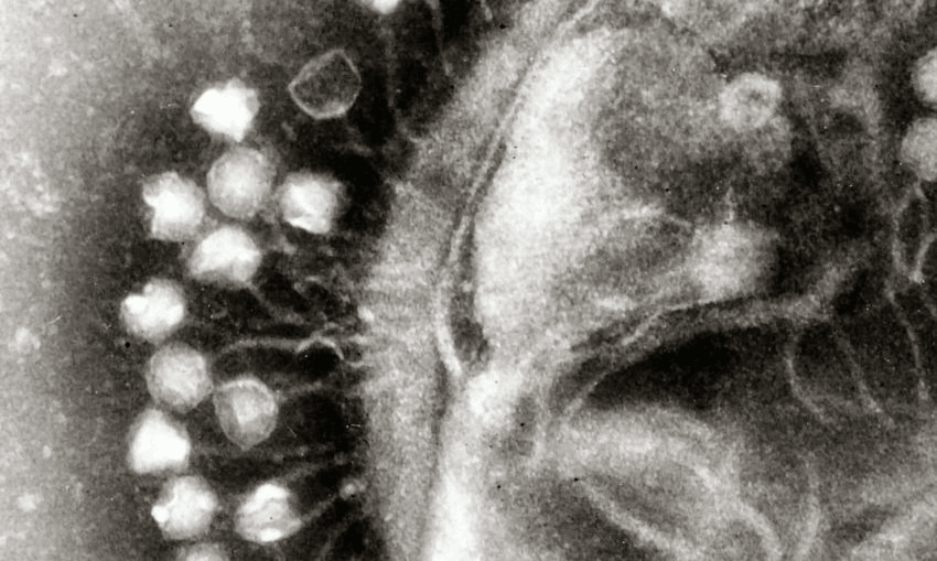 Bacteriophages attached to a bacterial cell 
