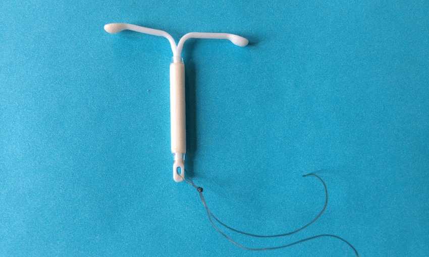 This is what a Mirena IUD looks like. Photo: Wikimedia 
