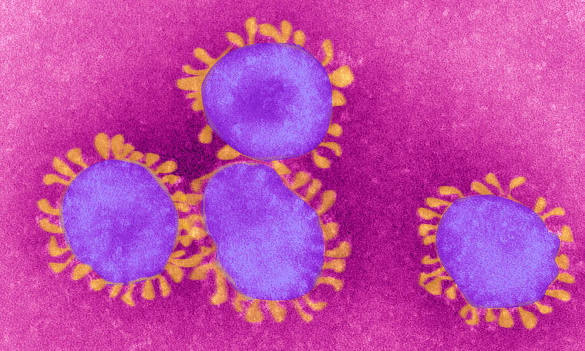 The Coronaviruses Owe Their Name To The The Crown Like Projections, Visible Under Microscope, That Encircle The Capsid. The Coronaviruses Are Responsible For Respiratory Ailments And Gastro Enteritis. The Virus Responsible For Sars Belongs To This Family. (Photo By BSIP/UIG Via Getty Images) 
