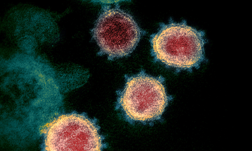 Microscopic view of the virus which causes Coronavirus disease. (Image: NIAID-RML) 
