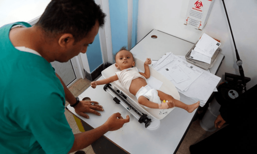 A doctor in Yemen weighing a malnourished child, where more than one in four children are acutely malnourished. (Getty Images)