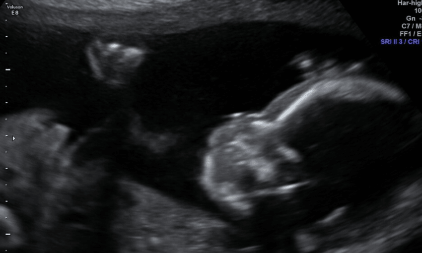 Awa! Image: Supplied