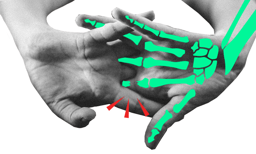 Irritating, yes, dangerous, no The truth about cracking your knuckles