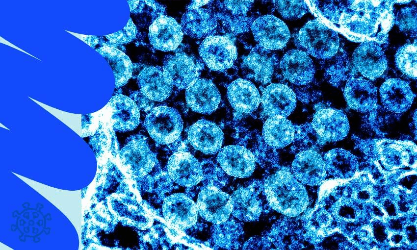 Transmission electron micrograph of SARS-CoV-2 virus particles, isolated from a patient. (Image: NIAID, CC BY 2.0, additional design by Tina Tiller) 
