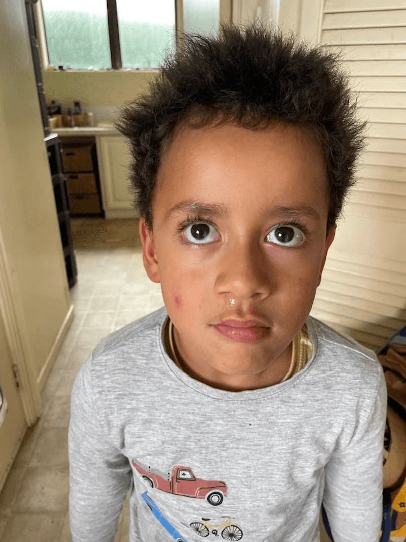 Photo of a young boy with a runny nose. Big beautiful brown eyes and a very solemn look. 