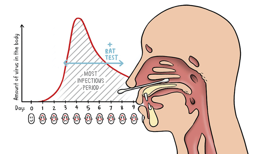 RATs can pick up a Covid infection when viral load is high. Illustration: Toby Morris 
