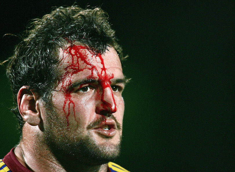 Head and shoulders shot of a male rugby player, not looking at camera, blood streaming down his face. 