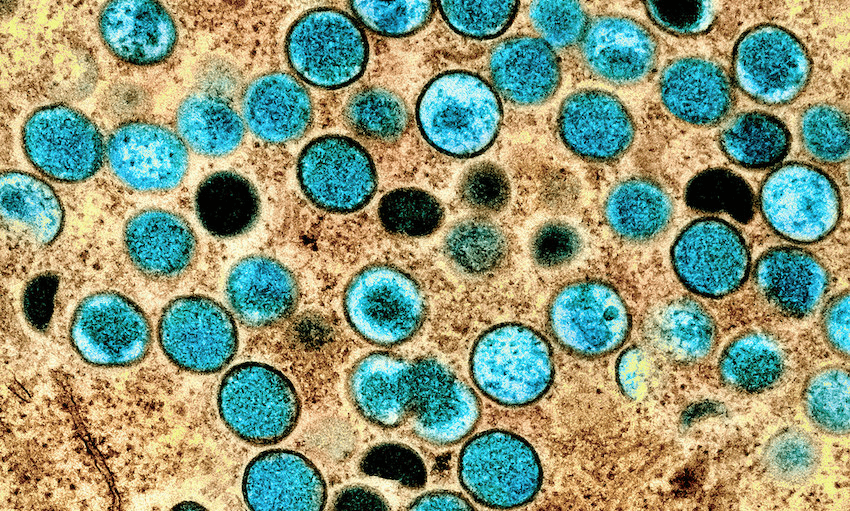 Colorized transmission electron micrograph of monkeypox particles (teal) found within an infected cell (brown), (. Credit: NIAID/CC BY 2.0) 
