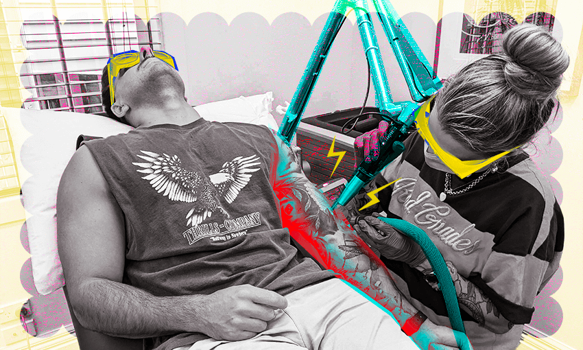 Laser removal hurts ‘way worse than a tattoo’. (Design: Tina Tiller) 
