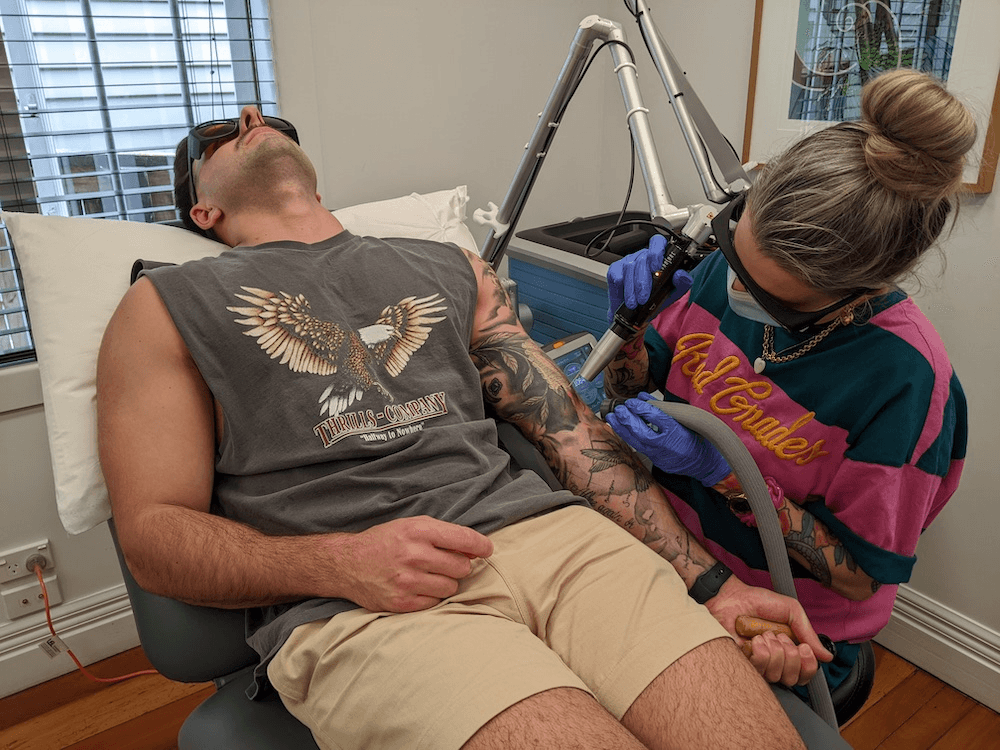 Best Tattoo Removal Treatments in Christchurch Central, Christchurch |  Fresha