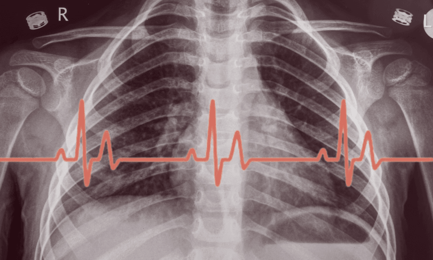 A thank you to the family who gave my child a heart