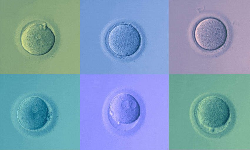 Human eggs under the microscope (Image: Gabi Lardies). 
