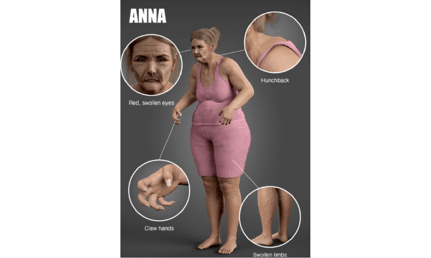 An AI image showing an old haggard-looking woman with various health concerns highlighted