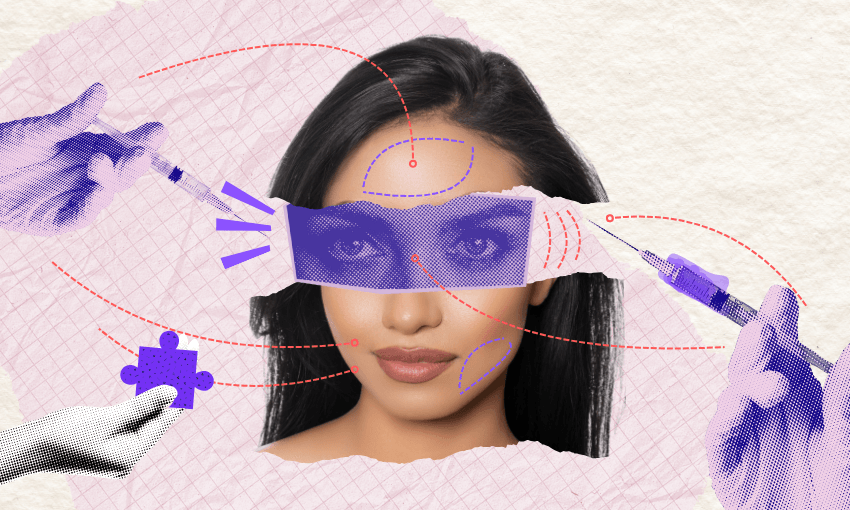 Is everyone getting Botox without me? 