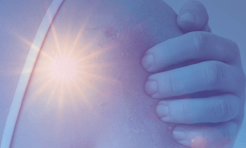 The sun, a scab – and stage 3 melanoma