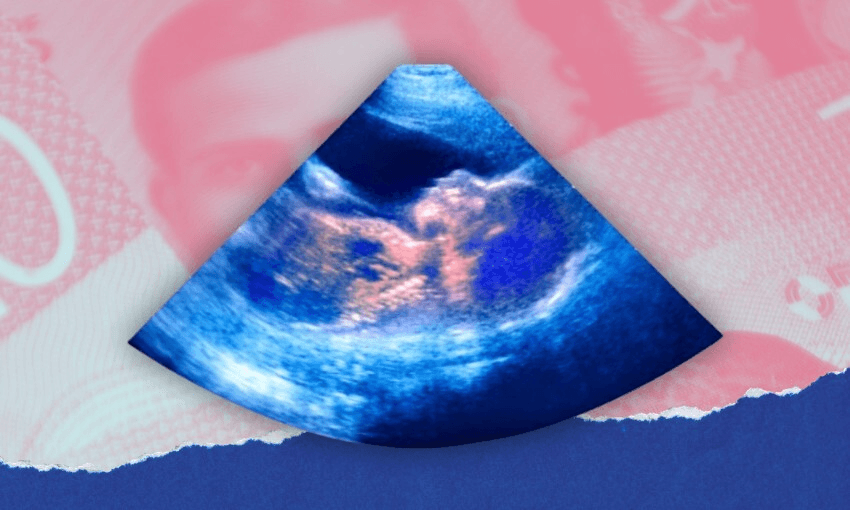 Why does fertility treatment cost so much in New Zealand?