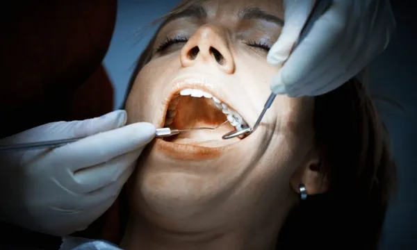 a person wincing in pain with dental instruments in their mouth