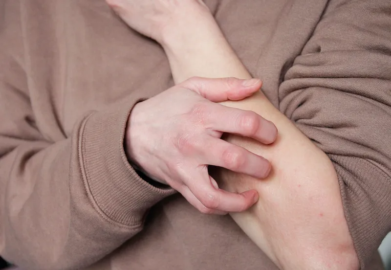 Scratching