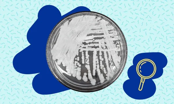 The fungus candida auris sits in a petri dish in black and white. the background is blue