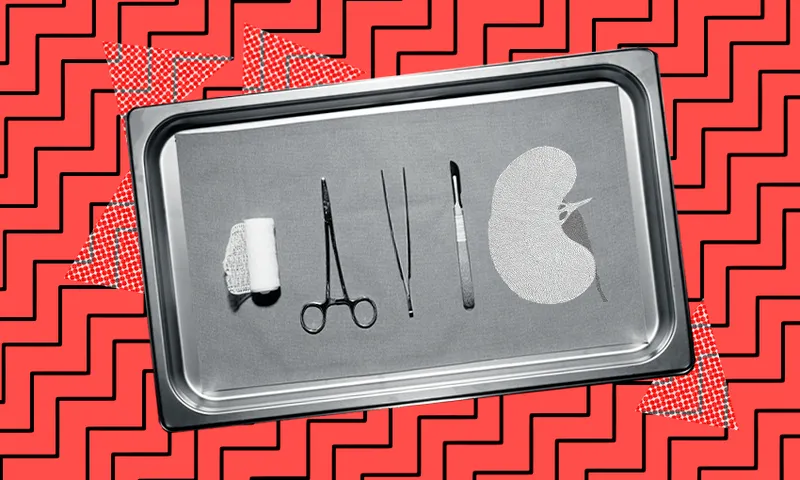 surgical-tools-kidney.png