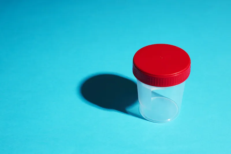 medical sample container for clinical test. empty bottle with red cup and hard shadow over blue background. copy space.