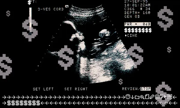 IRL-Costly-Scans