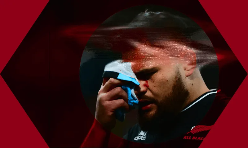 head injuries