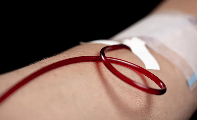 Voluntary blood donation on the go and hemodialysis