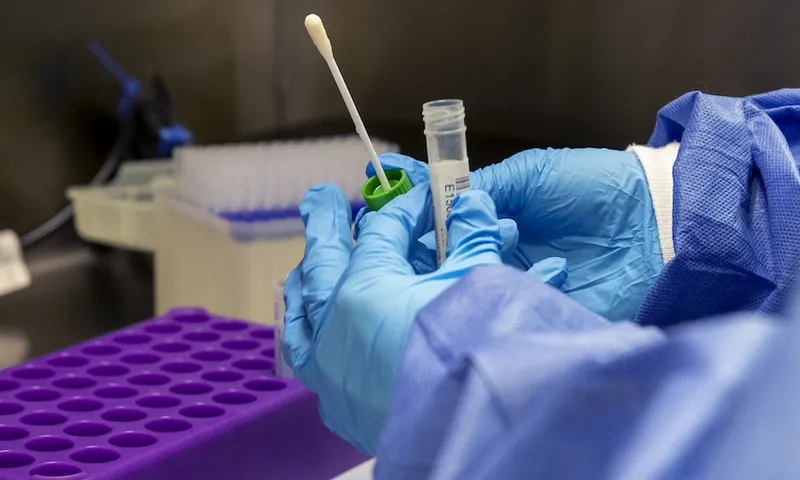Coronavirus – Tue Oct 20, 2020
