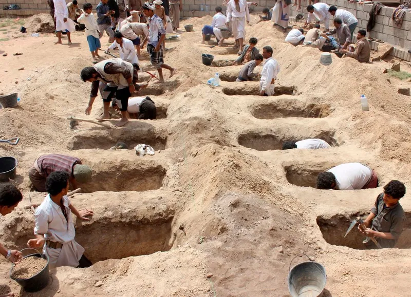 TOPSHOT-YEMEN-CONFLICT-CHILDREN-SAUDI