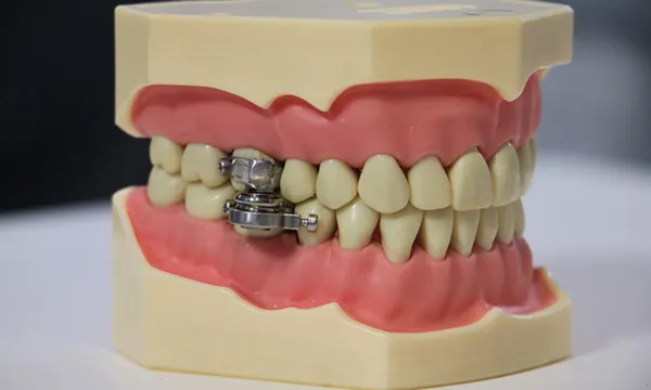 otago-teeth-feat (1)