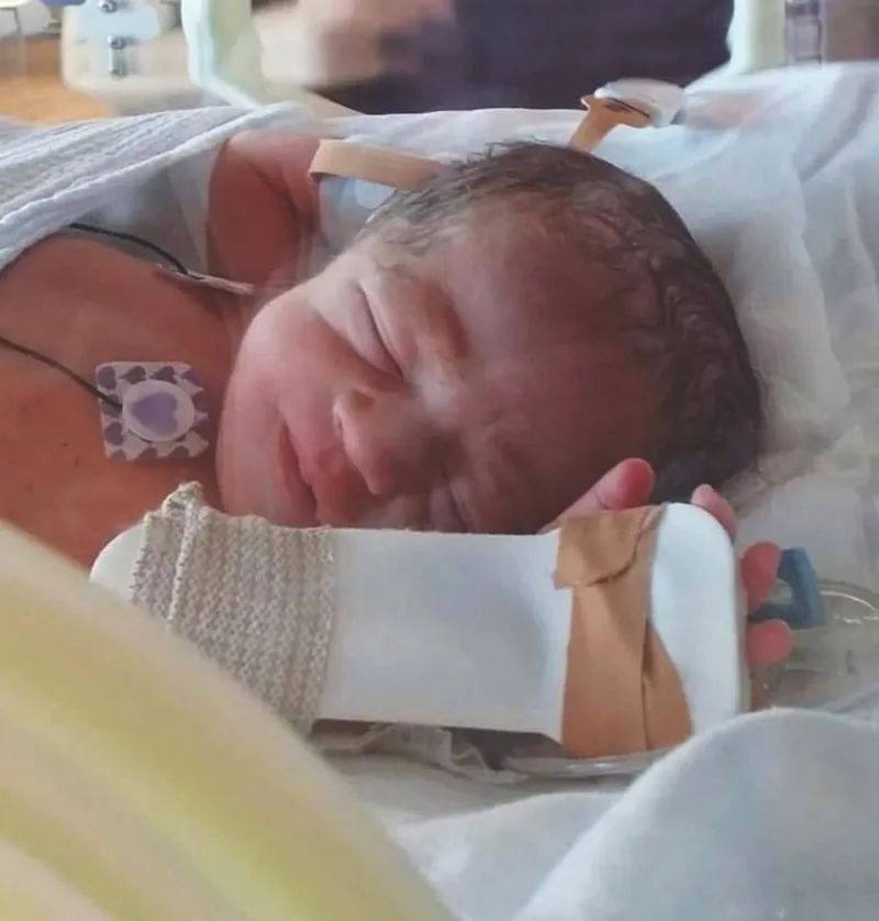 Photograph of a newborn, lots of tubing, an IV line etc. Absolutely beautiful.