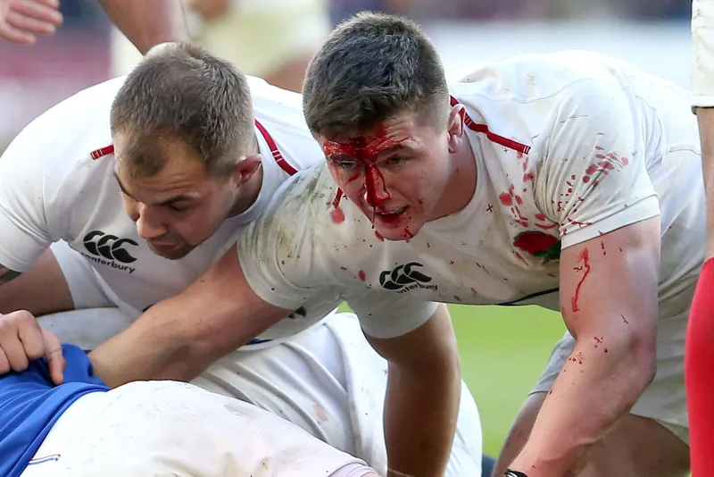 England v France - Guinness Six Nations