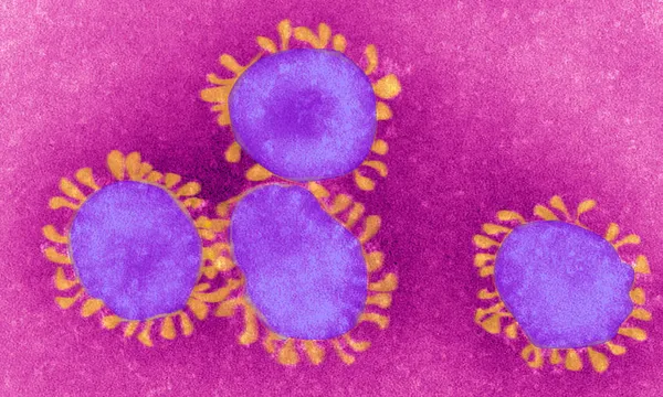 Coronavirus, Tem