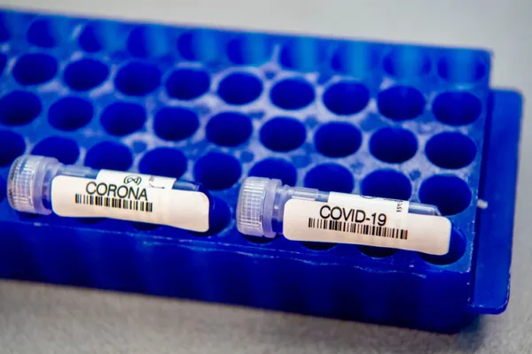 Test tubes with samples of blood being tested for COVID-19