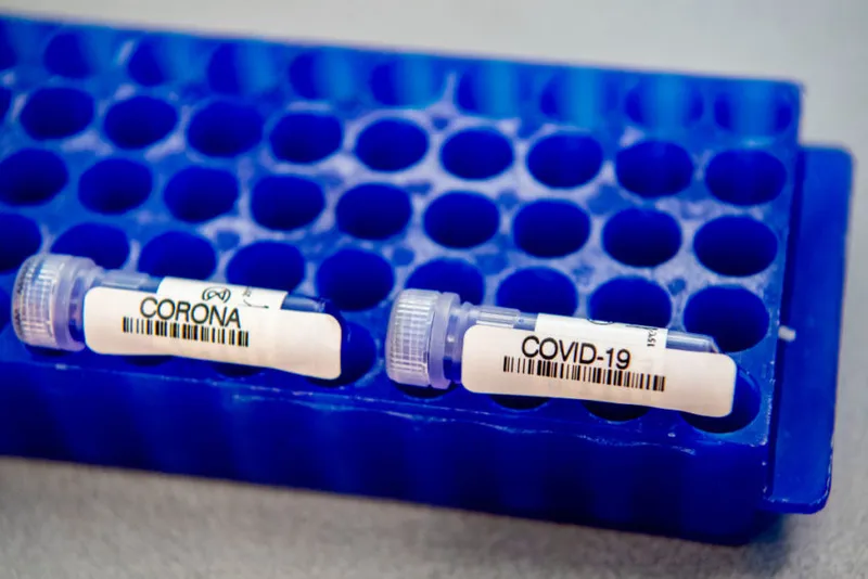 Test tubes with samples of blood being tested for COVID-19