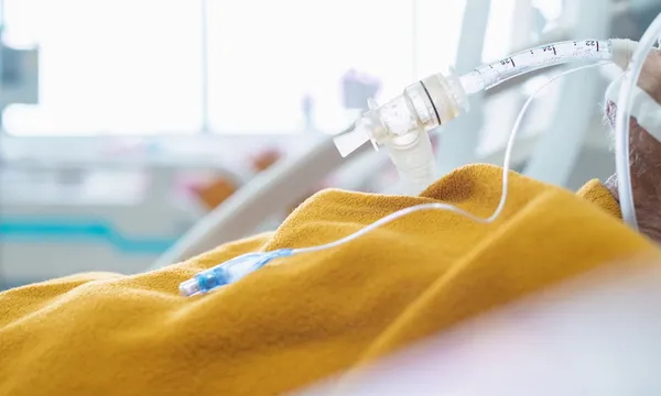 Endotrachel tube giving oxygen to illness human