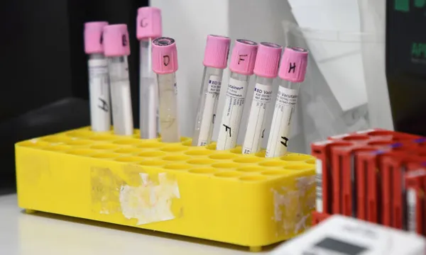 Government Announces Health Investment For COVID-19 Response And Recovery
