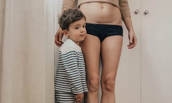 mother with c-section scar and children