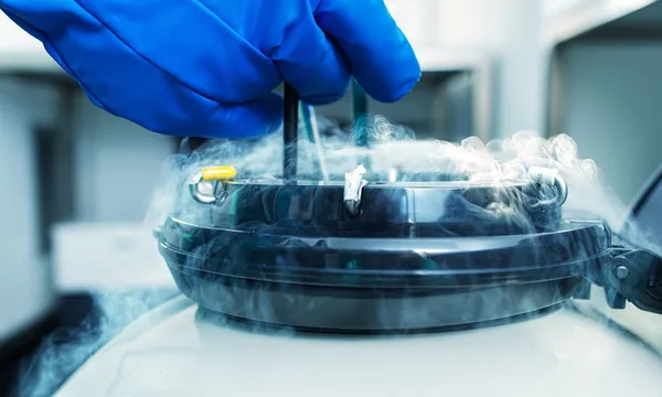 Sample of sperm frozen tank