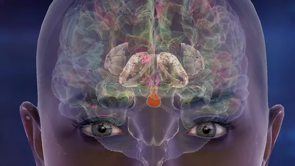 Rachel’s Brain
