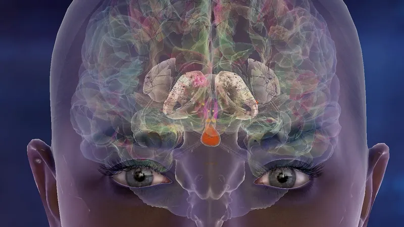 Rachel’s Brain