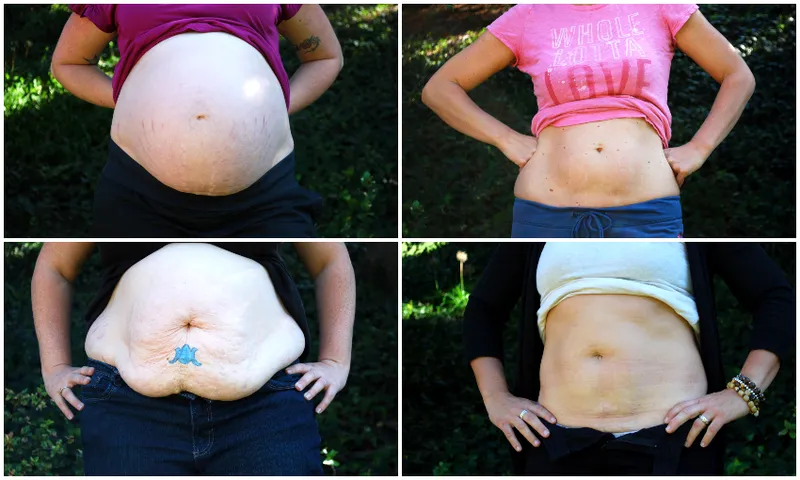 Post partum bodies feature image
