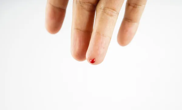 Photo for bloody finger in close up