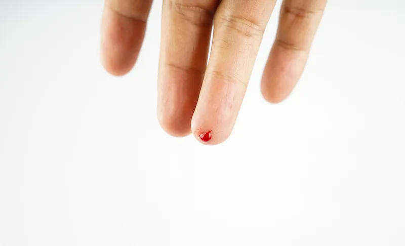 Photo for bloody finger in close up
