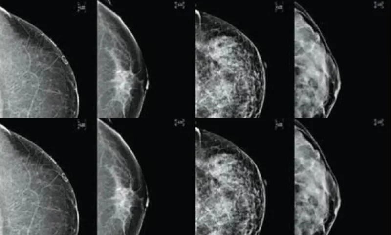breast