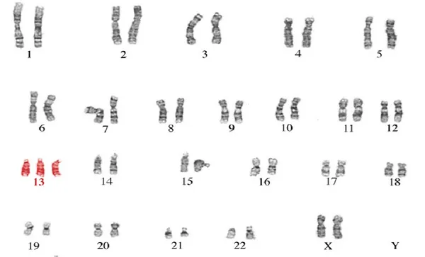 chromosome